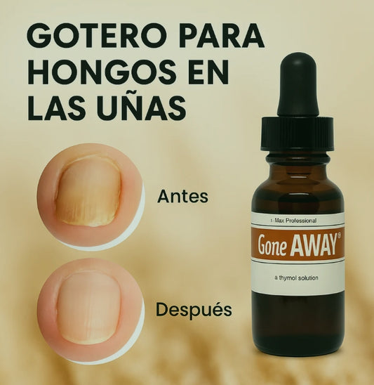 ✨ Gotero Antihongos Natural 🌿💧 | ¡Despídete de los hongos al instante! 🦶🚫